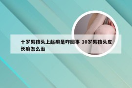 十岁男孩头上起癣是咋回事 10岁男孩头皮长癣怎么治