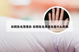 白斑处毛发变白 白斑处毛发变白是什么疾病