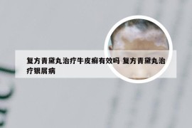 复方青黛丸治疗牛皮癣有效吗 复方青黛丸治疗银屑病