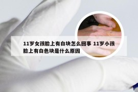 11岁女孩脸上有白块怎么回事 11岁小孩脸上有白色块是什么原因