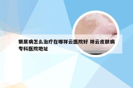 银屑病怎么治疗在哪祥云医院好 祥云皮肤病专科医院地址