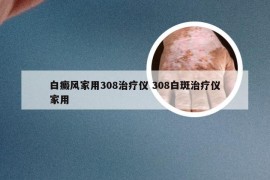 白癜风家用308治疗仪 308白斑治疗仪家用