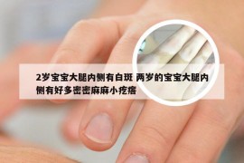 2岁宝宝大腿内侧有白斑 两岁的宝宝大腿内侧有好多密密麻麻小疙瘩