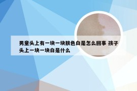 男童头上有一块一块肤色白是怎么回事 孩子头上一块一块白是什么