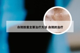 白斑胶囊主要治疗方法 白斑的治疗