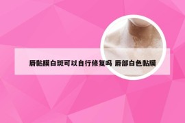 唇黏膜白斑可以自行修复吗 唇部白色黏膜