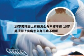 15岁男孩脚上有癣怎么办不疼不痒 15岁男孩脚上有癣怎么办不疼不痒呢