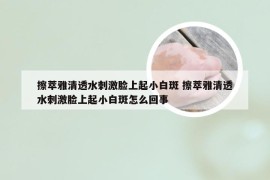 擦萃雅清透水刺激脸上起小白斑 擦萃雅清透水刺激脸上起小白斑怎么回事