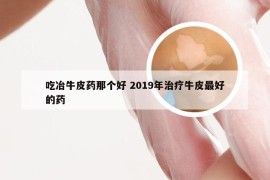 吃冶牛皮药那个好 2019年治疗牛皮最好的药