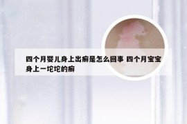 四个月婴儿身上出癣是怎么回事 四个月宝宝身上一坨坨的癣