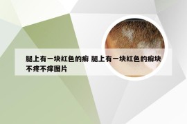 腿上有一块红色的癣 腿上有一块红色的癣块不疼不痒图片