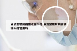 点滴型银屑病输液输头孢 点滴型银屑病输液输头孢管用吗