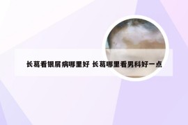 长葛看银屑病哪里好 长葛哪里看男科好一点