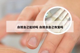 白斑自己能好吗 白斑会自己恢复吗