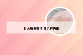 什么癣会疫传 什么藓传染