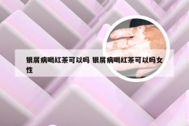 银屑病喝红茶可以吗 银屑病喝红茶可以吗女性