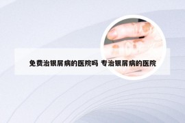 免费治银屑病的医院吗 专治银屑病的医院