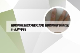 副银屑病治愈妙招交流吧 副银屑病的症状是什么样子的