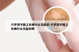 六岁孩子腿上长癣什么引起的 六岁孩子腿上长癣什么引起的呢