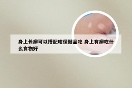 身上长癣可以搭配啥保健品吃 身上有癣吃什么食物好