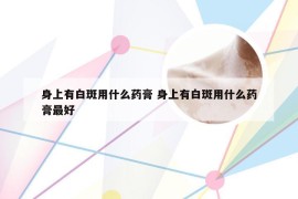 身上有白斑用什么药膏 身上有白斑用什么药膏最好