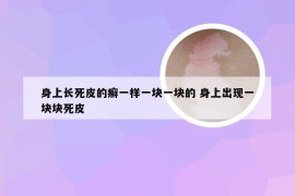 身上长死皮的癣一样一块一块的 身上出现一块块死皮