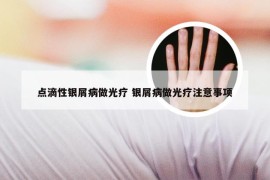 点滴性银屑病做光疗 银屑病做光疗注意事项