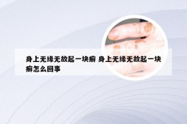 身上无缘无故起一块癣 身上无缘无故起一块癣怎么回事