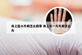 身上起小片癣怎么回事 身上长一片片癣怎么办