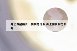 身上像起癣长一柄的是什么 身上像长癣怎么办