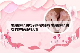 银屑病和长期吃辛辣有关系吗 银屑病和长期吃辛辣有关系吗女性