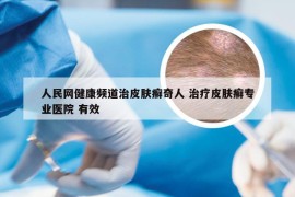 人民网健康频道治皮肤癣奇人 治疗皮肤癣专业医院 有效