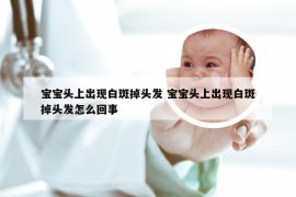 宝宝头上出现白斑掉头发 宝宝头上出现白斑掉头发怎么回事