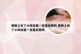 肩膀上长了小块白就一定是白斑吗 肩膀上长了小块白就一定是白斑吗