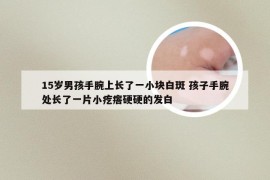 15岁男孩手腕上长了一小块白斑 孩子手腕处长了一片小疙瘩硬硬的发白