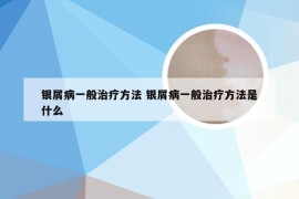 银屑病一般治疗方法 银屑病一般治疗方法是什么