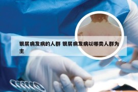 银屑病发病的人群 银屑病发病以哪类人群为主