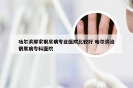 哈尔滨那家银屑病专业医院比较好 哈尔滨治银屑病专科医院