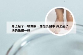 身上起了一块像癣一样怎么回事 身上起了一块的像癣一样