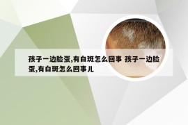 孩子一边脸蛋,有白斑怎么回事 孩子一边脸蛋,有白斑怎么回事儿