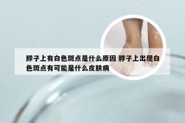 脖子上有白色斑点是什么原因 脖子上出现白色斑点有可能是什么皮肤病