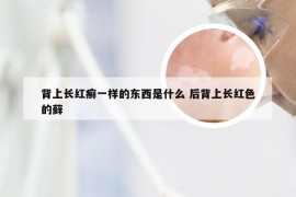 背上长红癣一样的东西是什么 后背上长红色的藓