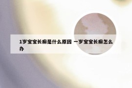 1岁宝宝长癣是什么原因 一岁宝宝长癣怎么办