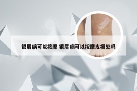 银屑病可以按摩 银屑病可以按摩皮损处吗