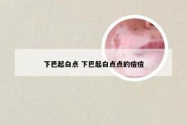 下巴起白点 下巴起白点点的痘痘