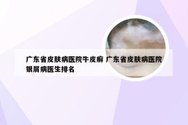 广东省皮肤病医院牛皮癣 广东省皮肤病医院银屑病医生排名