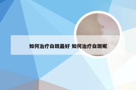 如何治疗白斑最好 如何治疗白斑呢