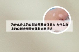 为什么身上的白斑会随着身体长大 为什么身上的白斑会随着身体长大而消退