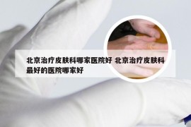 北京治疗皮肤科哪家医院好 北京治疗皮肤科最好的医院哪家好