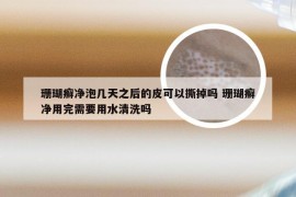 珊瑚癣净泡几天之后的皮可以撕掉吗 珊瑚癣净用完需要用水清洗吗